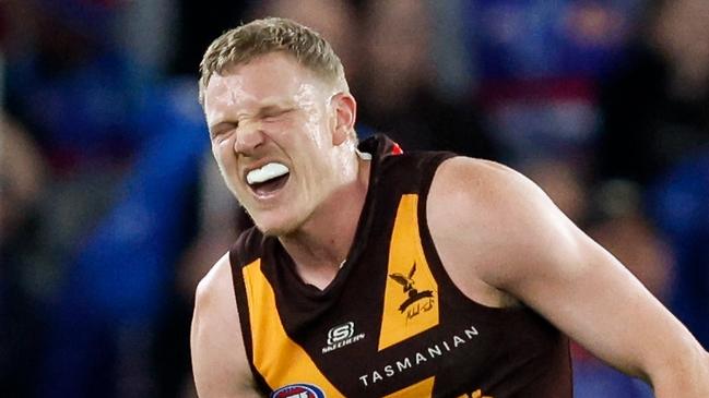 MELBOURNE, AUSTRALIA - MAY 05: James Sicily of the Hawks leaves the field with an injured shoulder during the 2024 AFL Round 08 match between the Western Bulldogs and the Hawthorn Hawks at Marvel Stadium on May 05, 2024 in Melbourne, Australia. (Photo by Dylan Burns/AFL Photos via Getty Images)