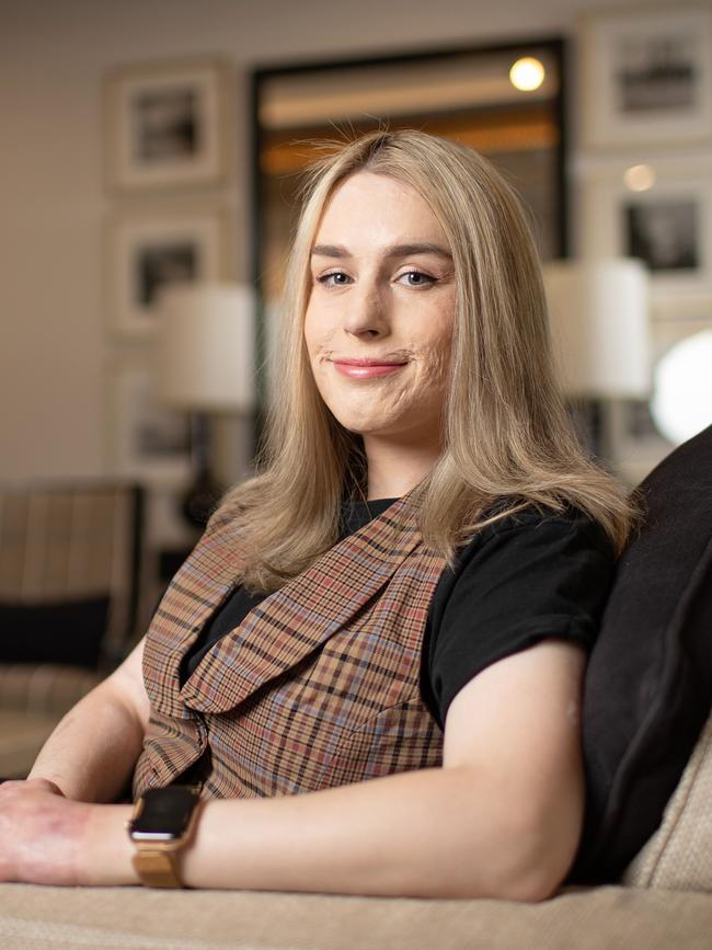 White Island volcano survivor Stephanie Browitt lost her dad and sister. Picture: Mark Stewart