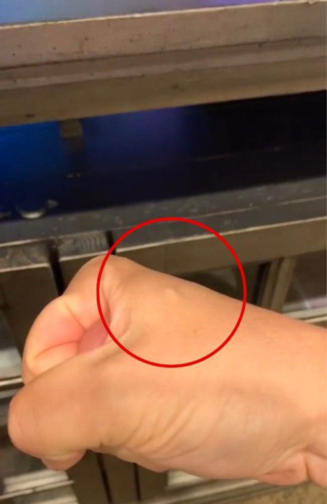 @Chipguyhere shows a bump where his chip has been implanted. Picture: TikTok