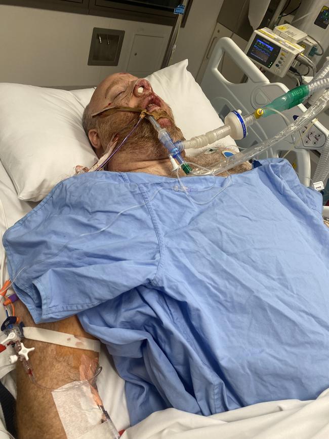 Chase Reid broken his nose, both wrists and pelvis among other injuries. Picture: Supplied