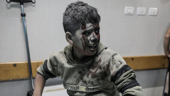 A young Palestinian boy injured in Israeli raids is treated at Nasser Medical Hospital in Khan Yunis, Gaza. Picture: Ahmad Hasaballah/Getty Images