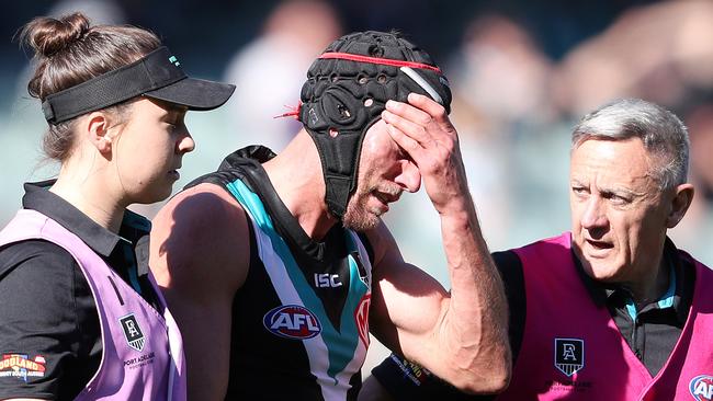 New test could revolutionise AFL concussion rule