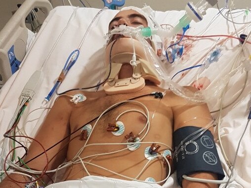 Nathan Joyce suffered massive head injuries when he was bashed by his mate Max Crimmins during a drunken night.