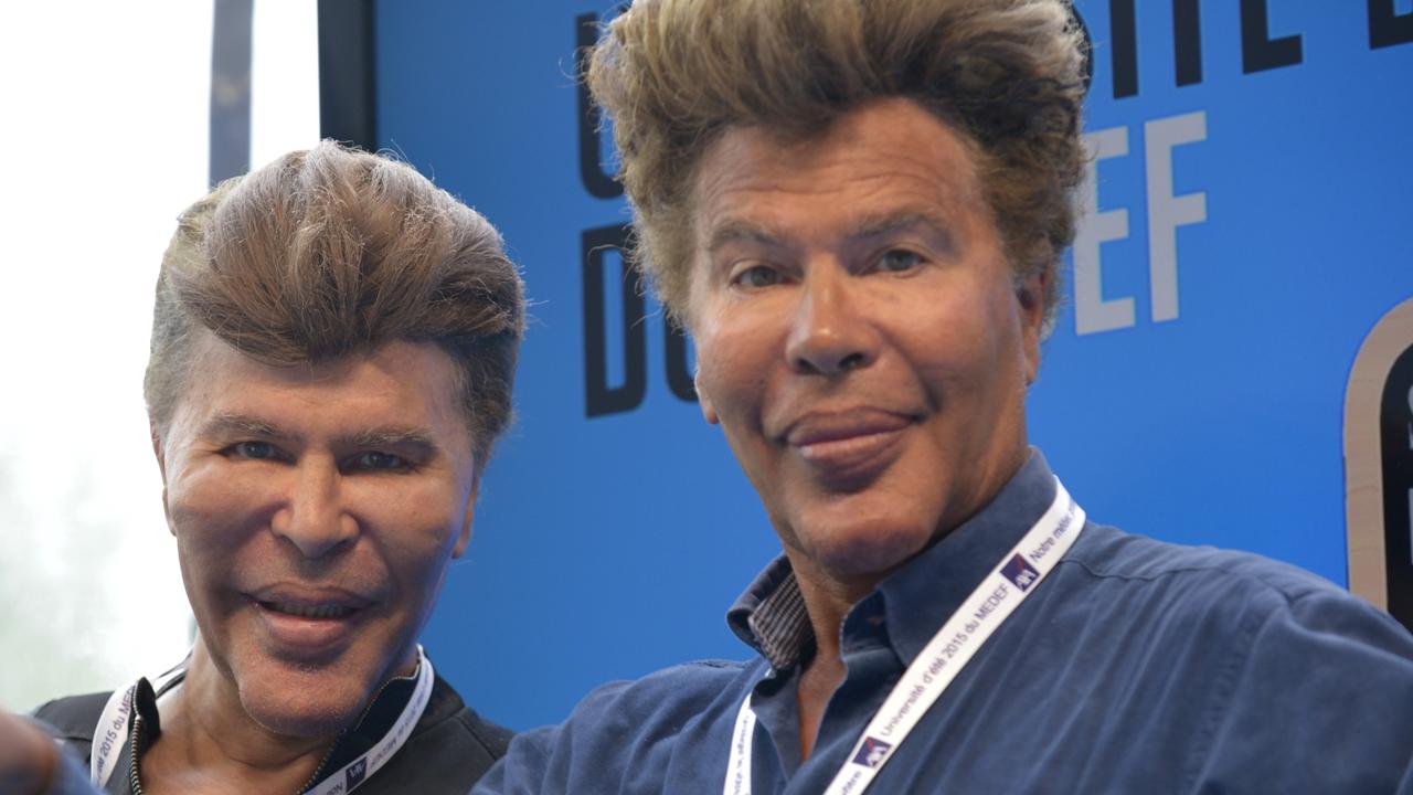Igor and Grichka Bogdanoff Extreme plastic surgery disasters and why