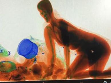 Woman in x-ray machine. Must credit Pear Video