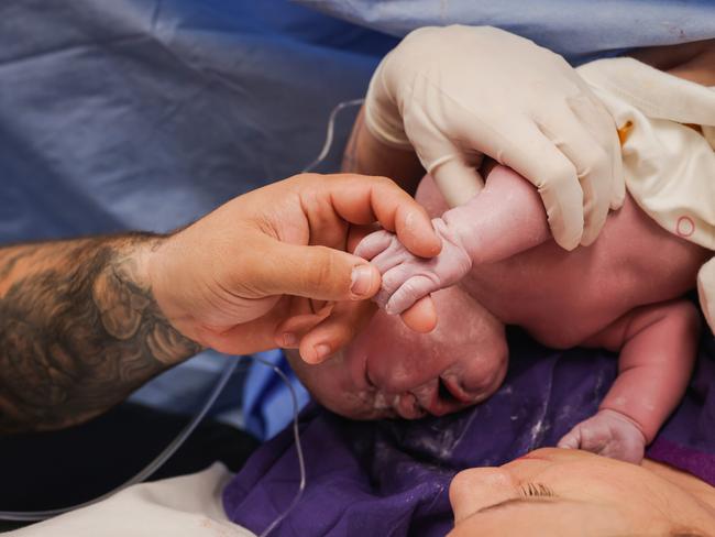 Epworth Freemasons is one of the few hospitals in Australia to offer maternal assisted caesareans.