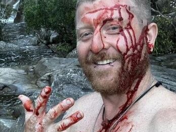 Joel Herrington was attacked by an aggressive python. Picture: Joel Herrington