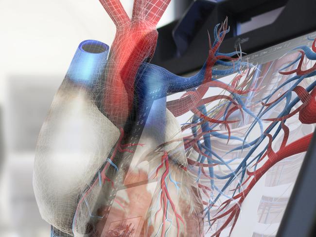 A doctor works on a 3D heart using an HP Zvr 23.6-inch virtual reality display.