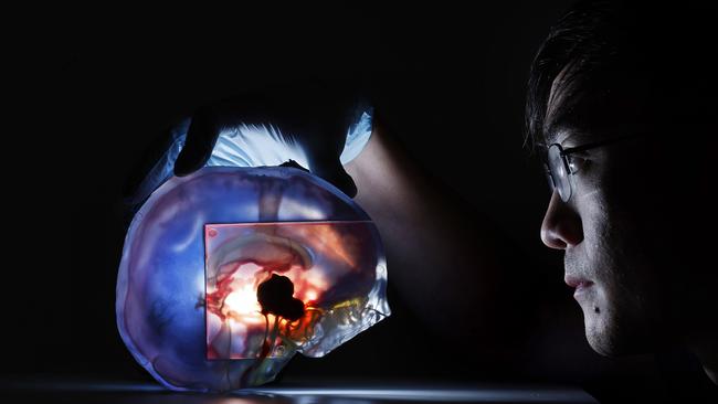 Keng-Yin Lai from UNSW inspects the 3D printout of Isaac’s brain that surgeons used to map out the surgery. Picture: Sam Ruttyn