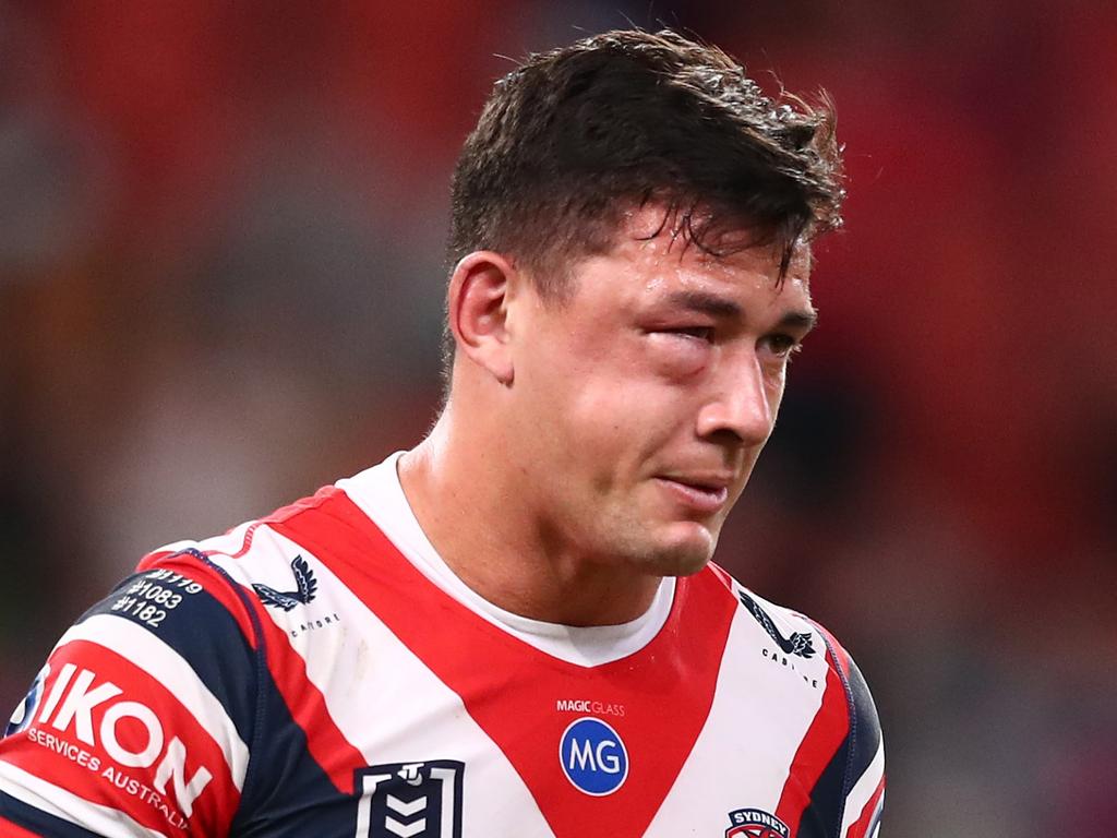 Latrell Mitchell’s hit sent Joey Manu to hospital, where he underwent emergency surgery on a fractured cheekbone. Picture: Chris Hyde/Getty Images