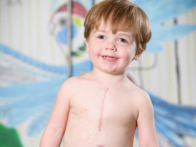 ‘Tiger’ Tom’s heart started failing when he was just 10 days old. Picture: Mark Stewart