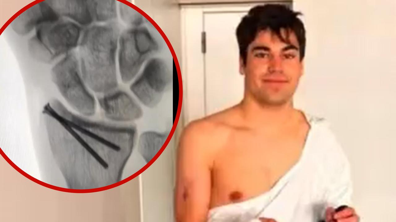 Lance Stroll sub image injury