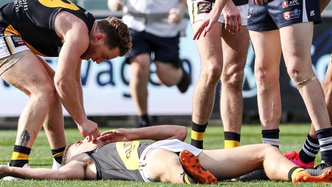 Glenelg’s Carl Nicholson is attended to by teammate Michael Virgin after being concussed in a game against South Adelaide in 2020. Picture: Sarah Reed