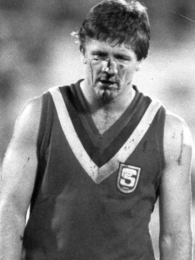 Chris McDermott spills blood for the SA guernsey in 1988.