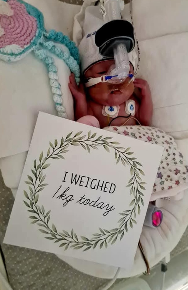 Stem cells were collected from her baby Billie’s umbilical cord blood and transfused back to her at 10 days to "shield" her brain from damage. Picture: Supplied