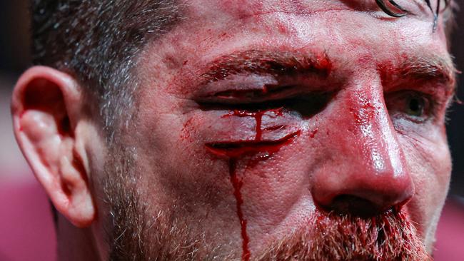 Jim Miller looks on after being defeated by Bobby Green. (Photo by Carmen Mandato/Getty Images)