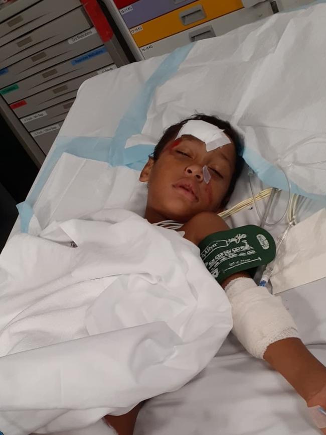 Five-year-old Paikea Hiko was seriously injured in a hit-and-run in Leanyer. Picture: Supplied