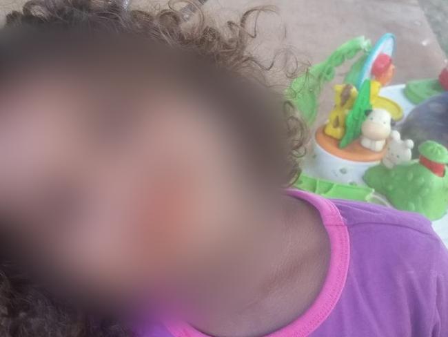 A two-year old girl was flown to hospital in a coma after suffering a suspected severe sexual assault in the Northern Territory town of Tennant Creek.