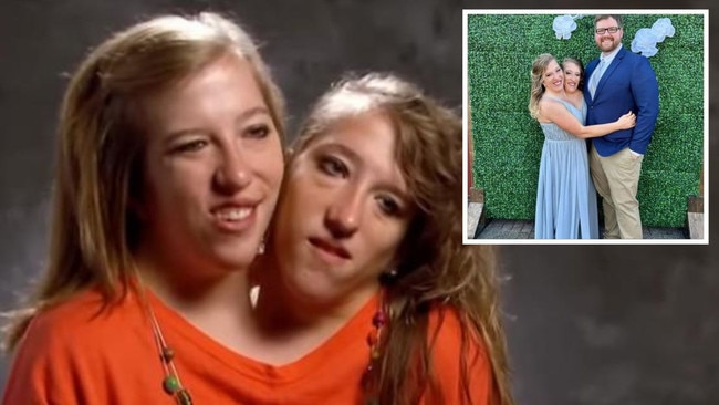 One of a pair of famous conjoined twins has tied the knot, prompting reaction from all around the world, and the bride has hit back.