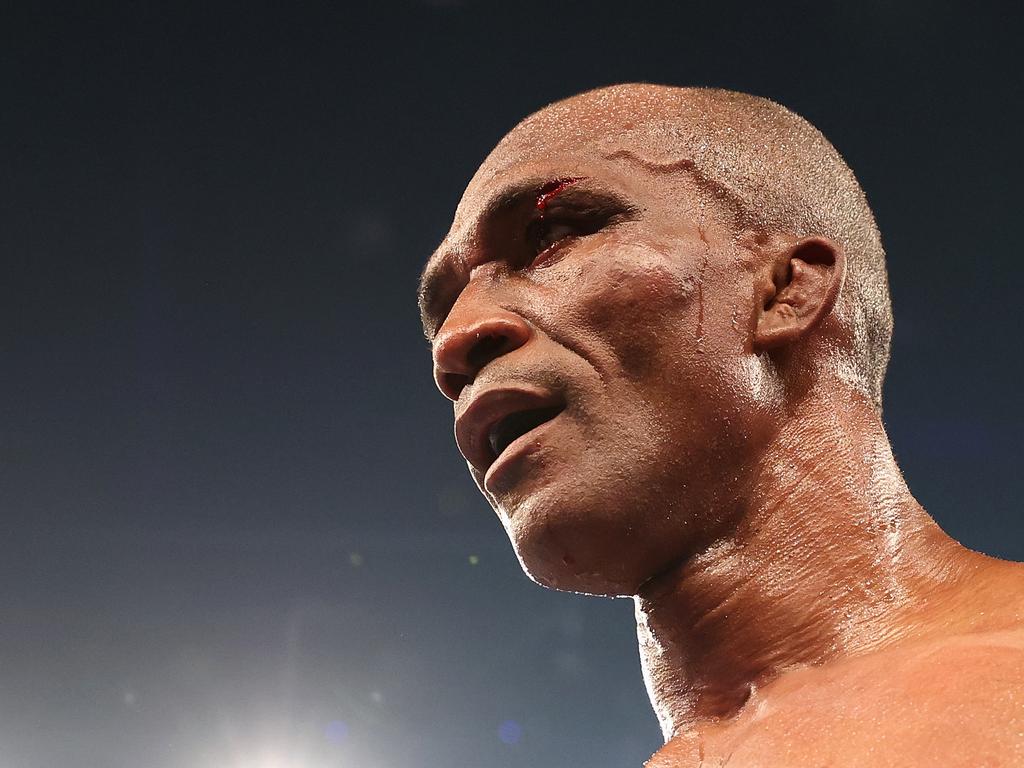 NEWCASTLE, AUSTRALIA - MARCH 31: Sakio Bika is seen with a cut above his eye during his Catchweight fight against Sam Soliman at Newcastle Entertainment Centre on March 31, 2021 in Newcastle, Australia. (Photo by Cameron Spencer/Getty Images)