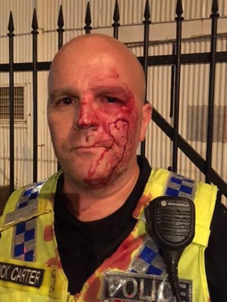 NT Police officer Nick Carter was coward punched outside Monsoons. He was knocked out and left bloodied and bruised from the attack.