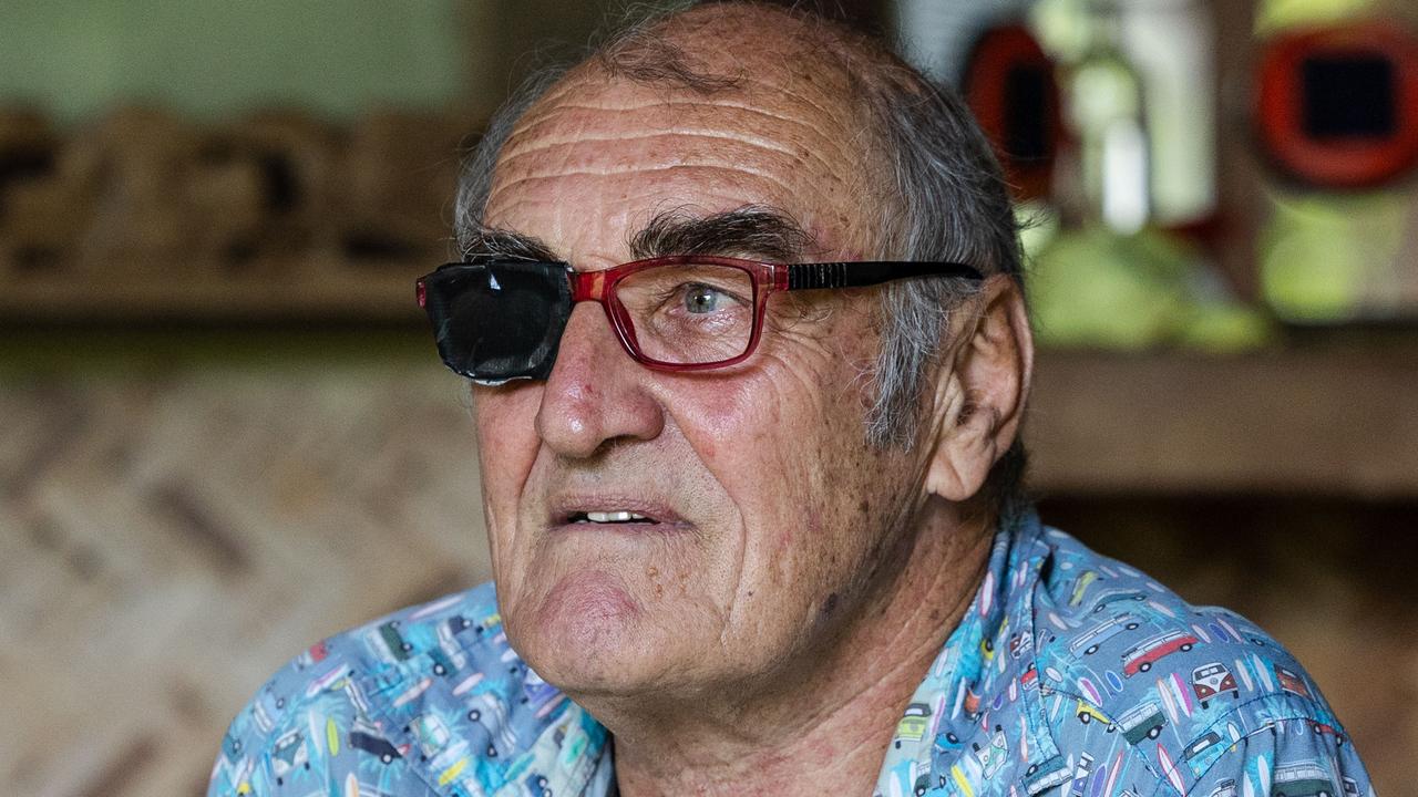 Darwin man Gavin Perry wants Voluntary Assisted Dying (VAD) to be an option in the Northern Territory, as he undergoes treatment for a rare form of eye cancer. Picture: Pema Tamang Pakhrin