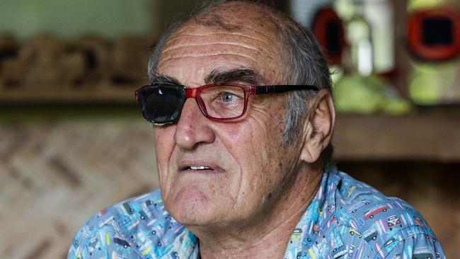 Darwin man Gavin Perry wants Voluntary Assisted Dying (VAD) to be an option in the Northern Territory, as he undergoes treatment for a rare form of eye cancer. Picture: Pema Tamang Pakhrin