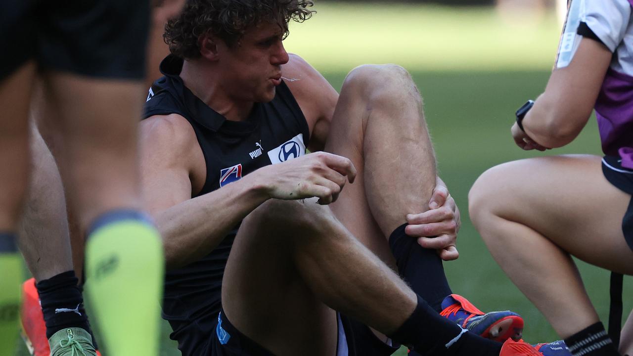 Charlie Curnow suffered a serious ankle injury. Picture: Daniel Pockett/Getty Images