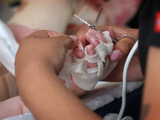 Jacob has been to the RCH more than 100 times in his first two years. Picture: David Caird