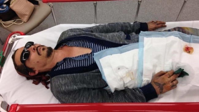 Johnny Depp in hospital with a severed finger. Picture: Schillings