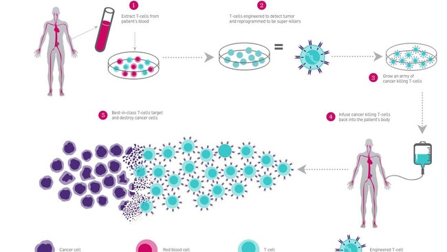 CAR-T therapy uses the body’s immune system to fight cancer. Picture: The Parker Institute