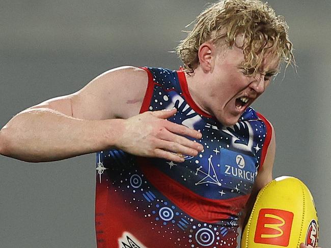 GEELONG, AUSTRALIA - JULY 07: Clayton Oliver of the Demons reacts after he was kicked in the hand during the round 17 AFL match between the Geelong Cats and the Melbourne Demons at GMHBA Stadium on July 07, 2022 in Geelong, Australia. (Photo by Robert Cianflone/Getty Images)