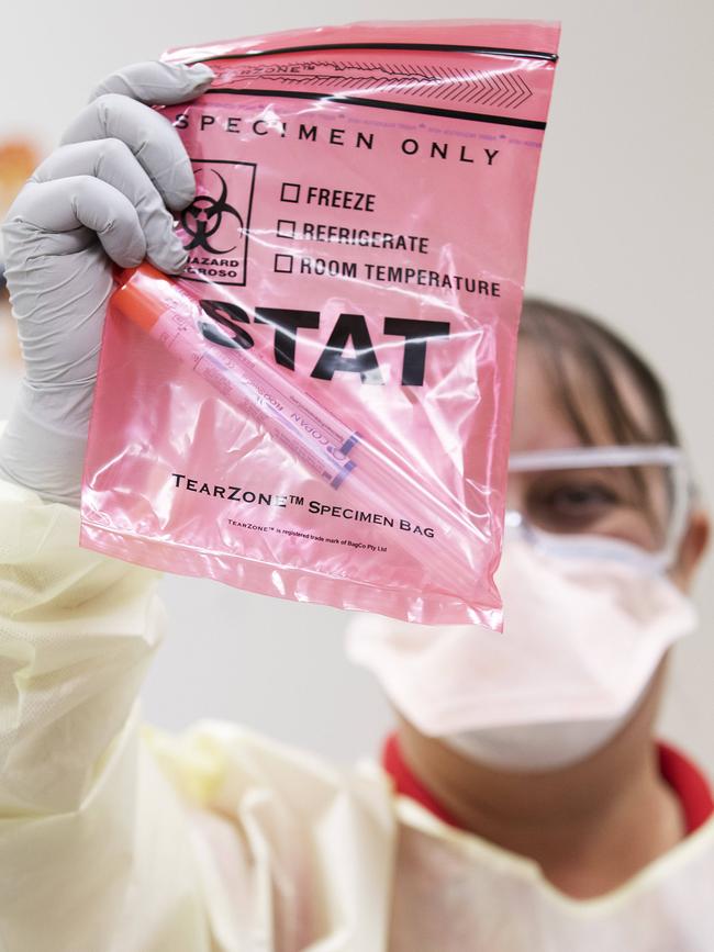 A nurse holds swabs from a patient check. Picture: AAP Image/Attila Csaszar