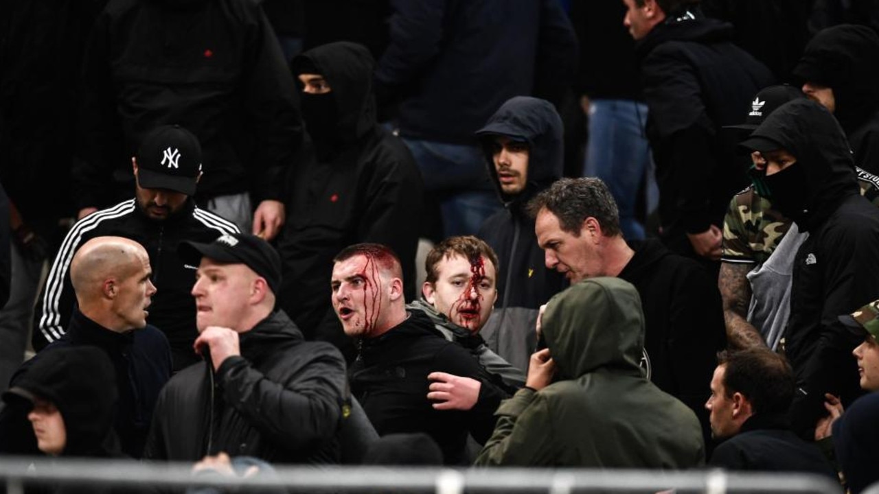 Fans were left bloodied and bruised following the chaotic violence in the stands