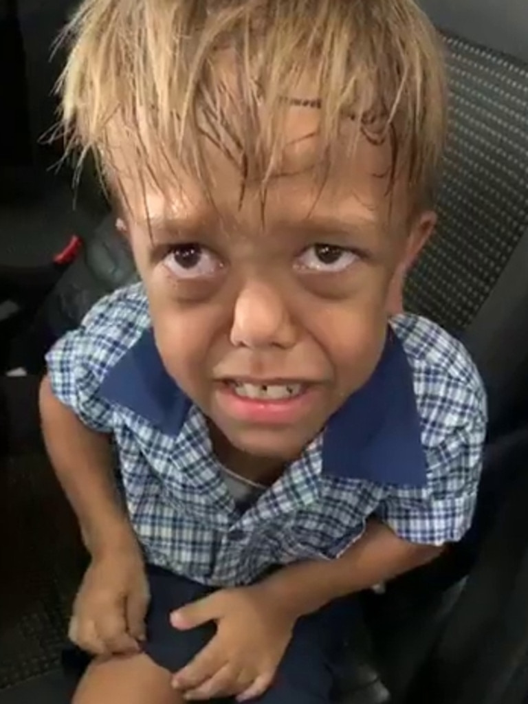 Queensland boy Quaden Bayles went viral earlier this year after footage of him distraught after suffering bullying at school was shared online. Picture: Supplied