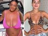 New boob trend young women love