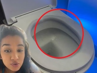 A mum-to-be has taken to social media to share a strange pregnancy symptom that left her thinking she was turning into a Smurf. Picture: TikTok