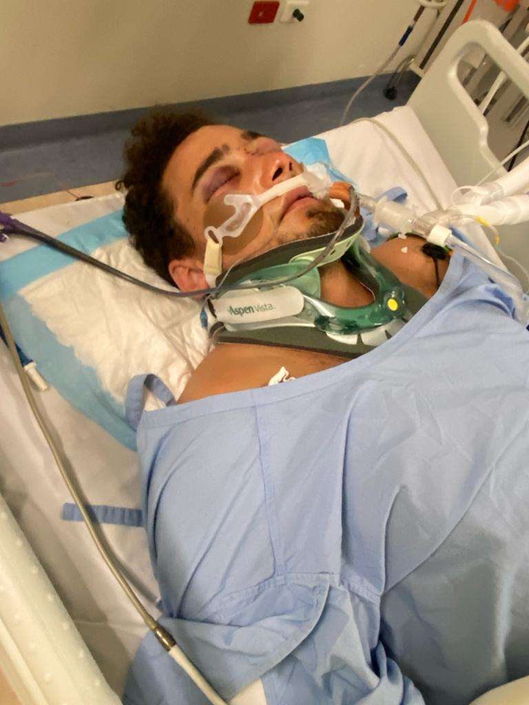 Paris Cockinos was left in a “shocking state” after a motorbike accident in 2020. Picture: Supplied.