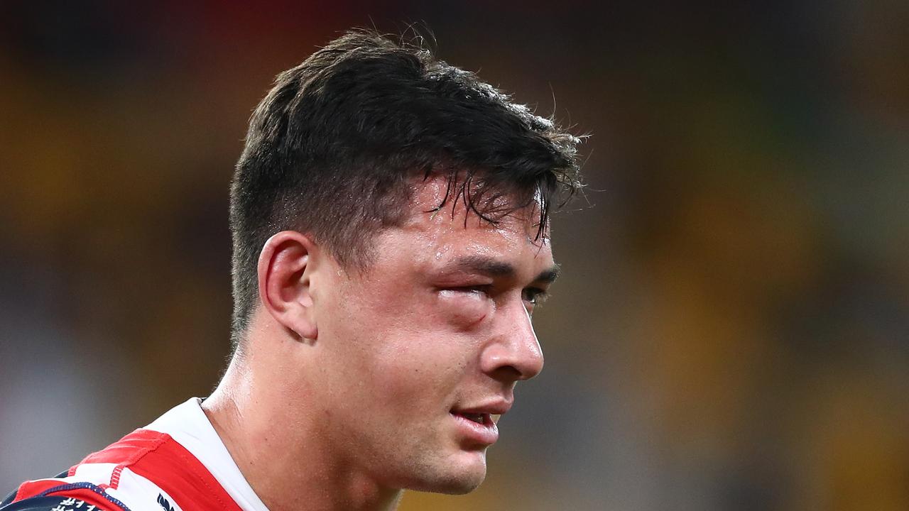 The Roosters injury curse has continued, with Joseph Manu suffering a suspected broken cheekbone. Picture: Getty Images.