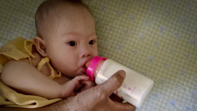 Left behind by biological parents ... Seven-month-old Down syndrome baby Gammy is fed in a Thailand hospital. Picture: Patrick Brown