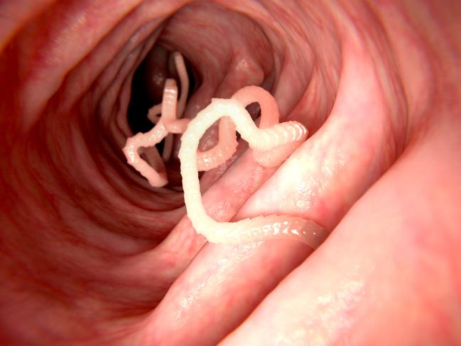 Image of a tapeworm. Picture: iStock