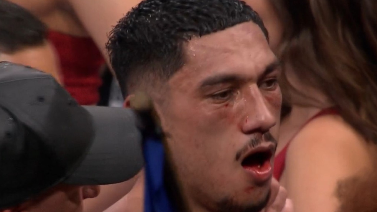 Jai Opetaia looks like he had a broken jaw. Photo: Fox Sports