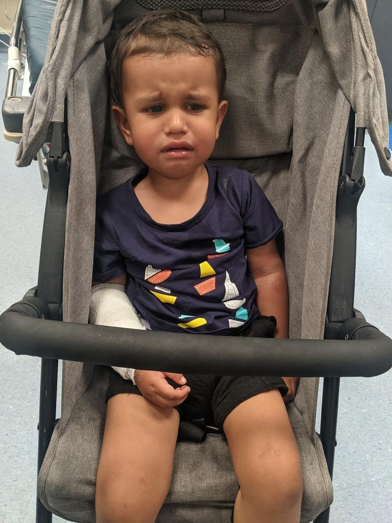 Darwin local Shauna Mounsey's toddler Lloyd Jayathilaka in the Royal Darwin Hospital after he was mauled by a dog in a Top End cafe. Picture: Supplied.