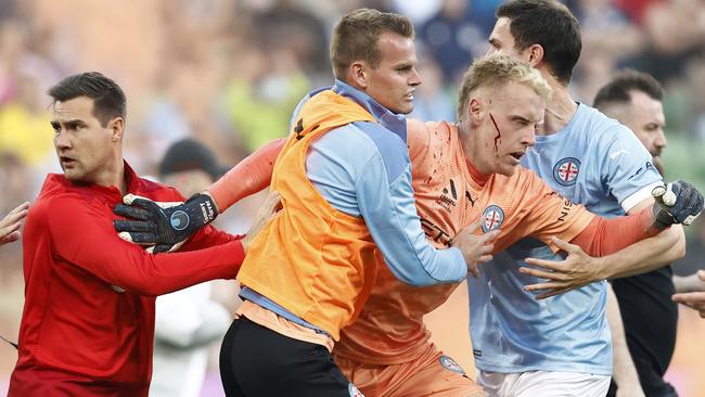 Melbourne City goalkeeper Tom Glover was left with a cut and a concussion after Victory fans stormed the field at the derby. (Photo by Darrian Traynor/Getty Images)