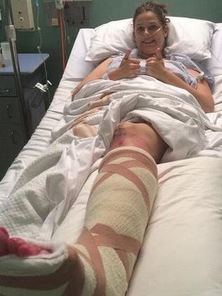 Kate Ellis in hospital after surgery to her leg in 2014.