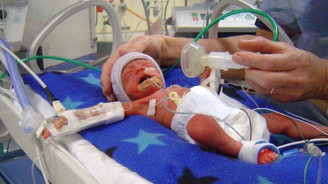 Carlos Celis was born premature at Mater Mothers' Hospital 18 years ago. Photo: Supplied.