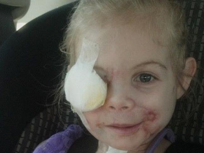 Victoria Wilcher, 3, was mauled by her grandfather’s pit bulls. Source: Facebook