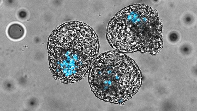 iBlastoids, models of early human embryos. Picture: Monash University