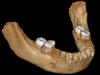 A handout photo made available by the Max Planck Institute for Evolutionary Anthropology on May 1, 2019 shows a view of the virtual reconstruction of the Xiahe mandible after digital removal of the adhering carbonate crust, which was found in 1980 in Baishiya Karst Cave. - The mandible is so well preserved that it allows for a virtual reconstruction of the two sides of the mandible. The Denisovan mandible likely represents the earliest hominin fossil on the Tibetan Plateau. (Photo by Jean-Jacques HUBLIN / the Max Planck Institute for Evolutionary Anthropology / AFP) / RESTRICTED TO EDITORIAL USE - MANDATORY CREDIT "AFP PHOTO / Max Planck Institute for Evolutionary Anthropology / Jean-Jacques HUBLIN" - NO MARKETING NO ADVERTISING CAMPAIGNS - DISTRIBUTED AS A SERVICE TO CLIENTS