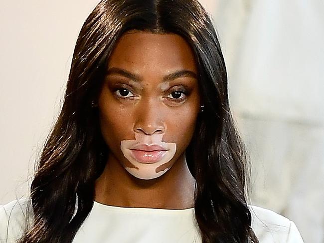 NEW YORK, NY - SEPTEMBER 06:  Model Winnie Harlow walks the runway for Nana Judy during New York Fashion Week: The Shows at Gallery II at Spring Studios on September 6, 2018 in New York City.  (Photo by Frazer Harrison/Getty Images for NYFW: The Shows)